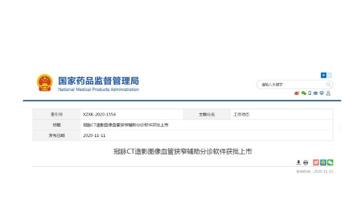 冠脉CT造影图像血管狭窄辅助分诊软件获批上市
